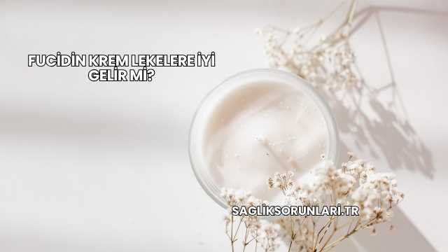 Fucidin Krem Lekelere İyi Gelir mi?