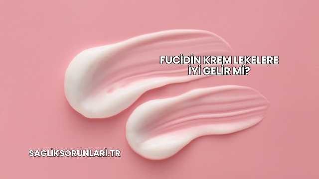 Fucidin Krem Lekelere İyi Gelir mi?