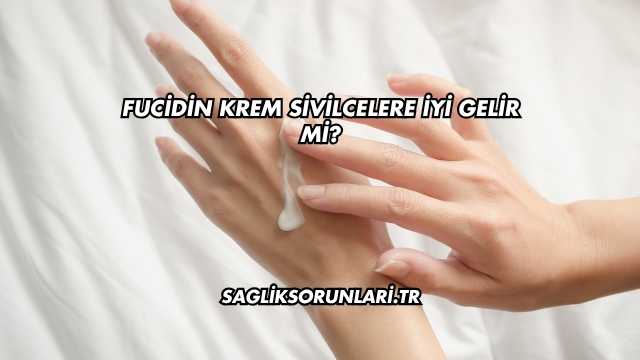 Fucidin Krem Sivilcelere İyi Gelir mi?