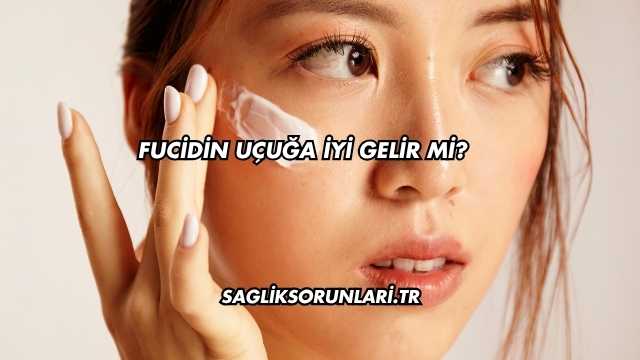 Fucidin Uçuğa İyi Gelir mi?