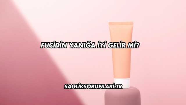 Fucidin Yanığa İyi Gelir mi?