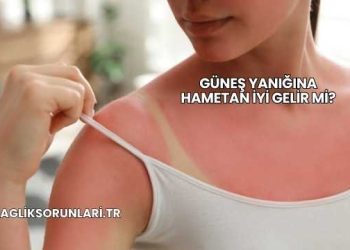 Güneş Yanığına Hametan İyi Gelir mi?