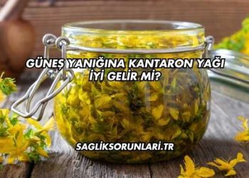 Güneş Yanığına Kantaron Yağı İyi Gelir mi?