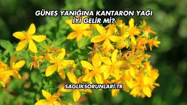 Güneş Yanığına Kantaron Yağı İyi Gelir mi?
