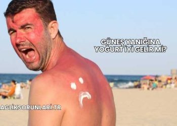 Güneş Yanığına Yoğurt İyi Gelir mi?