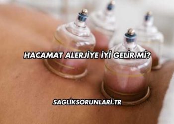 Hacamat Alerjiye İyi Gelir mi?