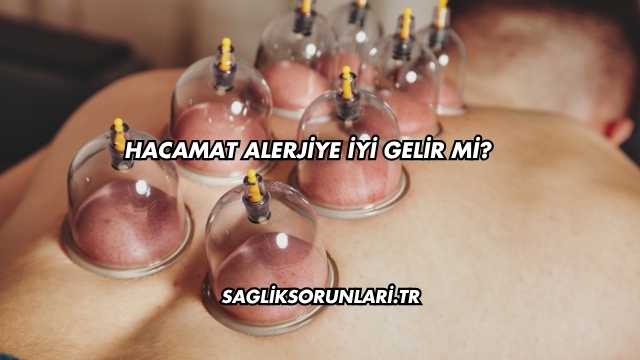 Hacamat Alerjiye İyi Gelir mi?
