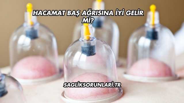 Hacamat Baş Ağrısına İyi Gelir mi?