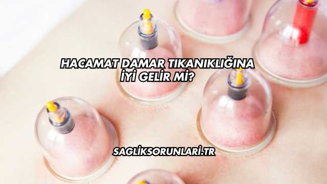 Hacamat Damar Tıkanıklığına İyi Gelir mi?