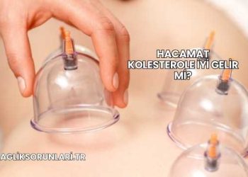 Hacamat Kolesterole İyi Gelir mi?