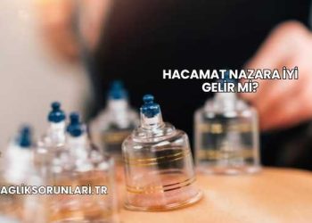 Hacamat Nazara İyi Gelir mi?