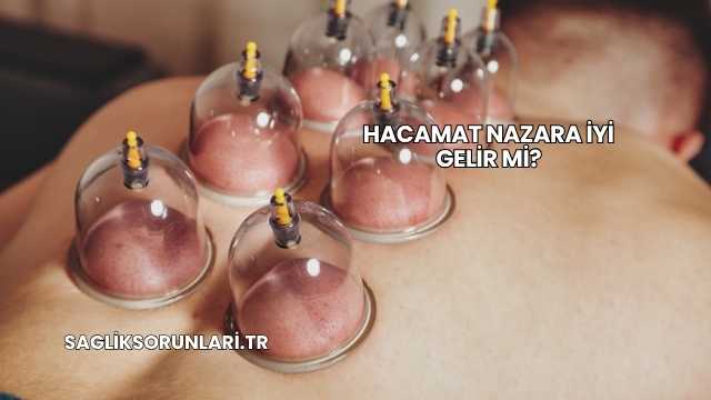 Hacamat Nazara İyi Gelir mi?