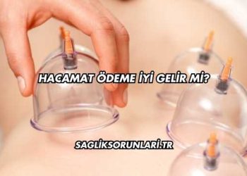 Hacamat Ödeme İyi Gelir mi?
