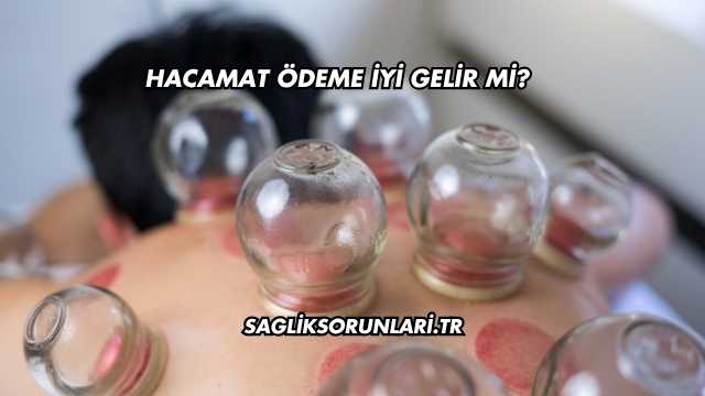 Hacamat Ödeme İyi Gelir mi?