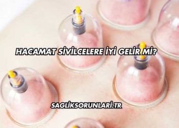 Hacamat Sivilcelere İyi Gelir mi?