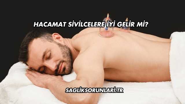 Hacamat Sivilcelere İyi Gelir mi?