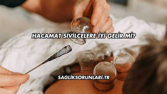Hacamat Sivilcelere İyi Gelir mi?
