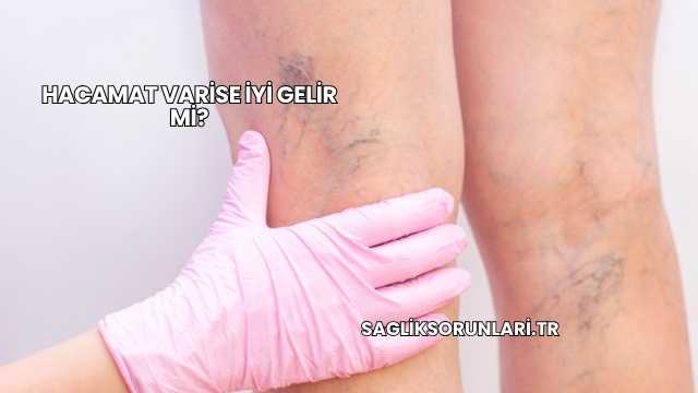 Hacamat Varise İyi Gelir mi?