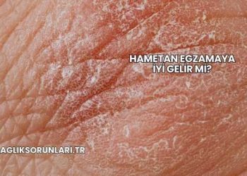 Hametan Egzamaya İyi Gelir mi?