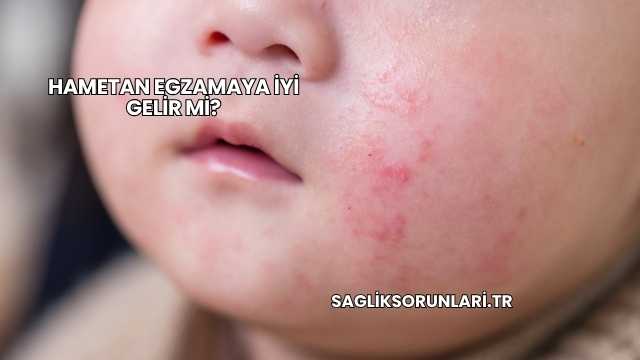 Hametan Egzamaya İyi Gelir mi?