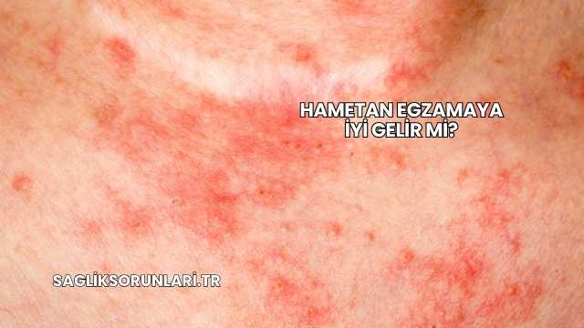 Hametan Egzamaya İyi Gelir mi?