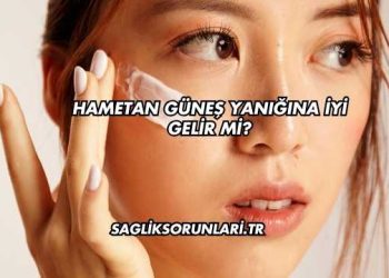 Hametan Güneş Yanığına İyi Gelir mi?