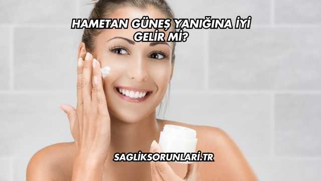 Hametan Güneş Yanığına İyi Gelir mi?