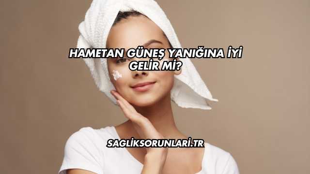 Hametan Güneş Yanığına İyi Gelir mi?
