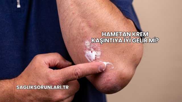 Hametan Krem Kaşıntıya İyi Gelir mi?