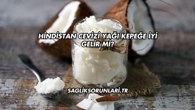 Hindistan Cevizi Yağı Kepeğe İyi Gelir mi?