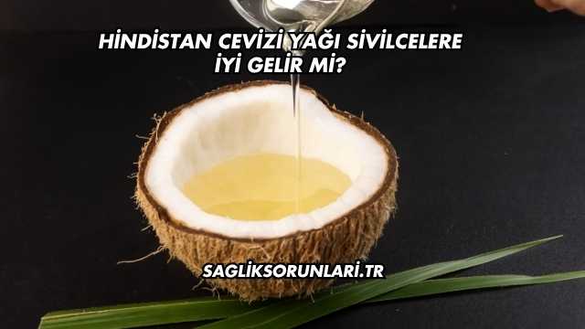 Hindistan Cevizi Yağı Sivilcelere İyi Gelir mi?