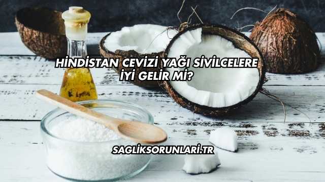 Hindistan Cevizi Yağı Sivilcelere İyi Gelir mi?
