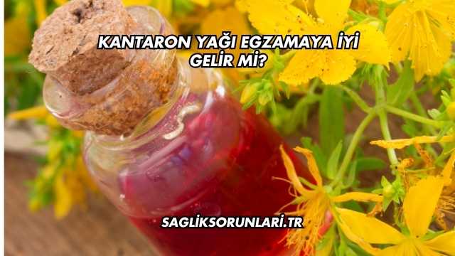 Kantaron Yağı Egzamaya İyi Gelir mi?