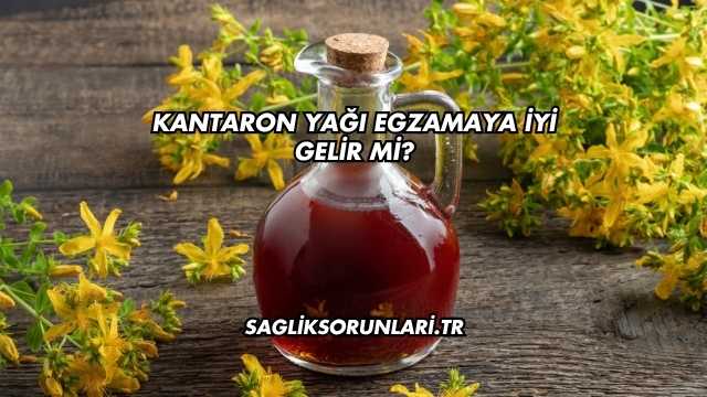 Kantaron Yağı Egzamaya İyi Gelir mi?