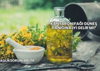 Kantaron Yağı Güneş Yanığına İyi Gelir mi?