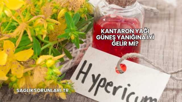 Kantaron Yağı Güneş Yanığına İyi Gelir mi?