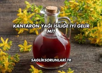 Kantaron Yağı İsiliğe İyi Gelir mi?