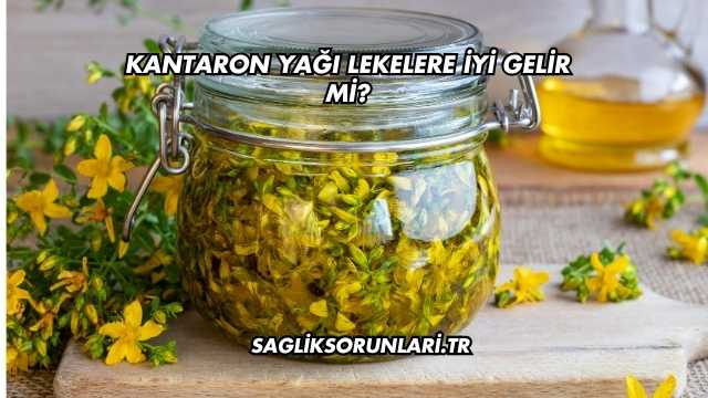 Kantaron Yağı Lekelere İyi Gelir mi?
