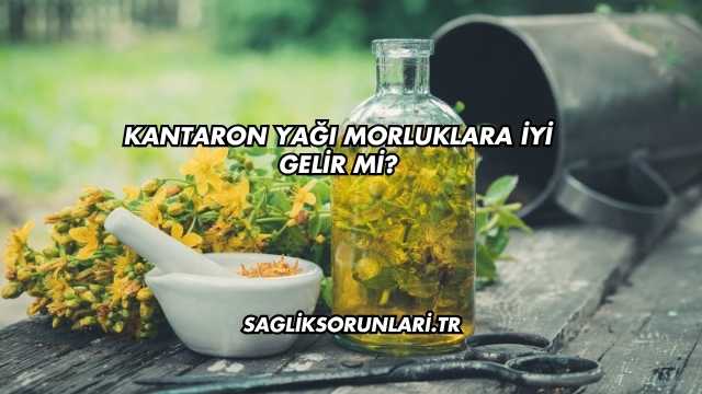 Kantaron Yağı Morluklara İyi Gelir mi?