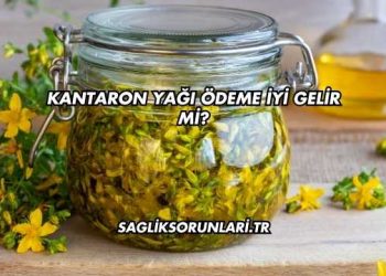Kantaron Yağı Ödeme İyi Gelir mi?