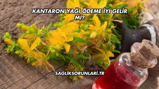 Kantaron Yağı Ödeme İyi Gelir mi?