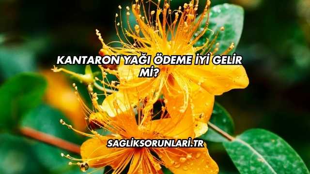 Kantaron Yağı Ödeme İyi Gelir mi?
