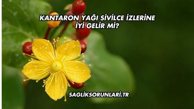 Kantaron Yağı Sivilce İzlerine İyi Gelir mi?
