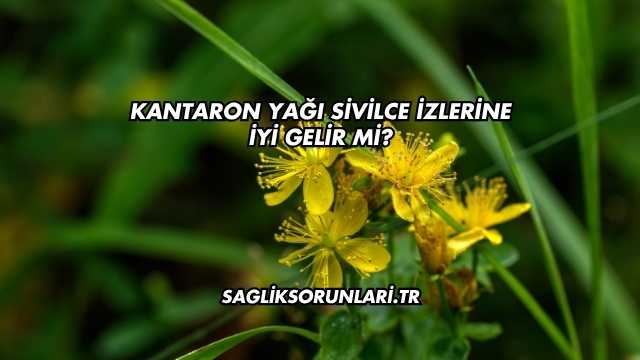Kantaron Yağı Sivilce İzlerine İyi Gelir mi?