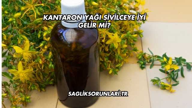 Kantaron Yağı Sivilceye İyi Gelir mi?