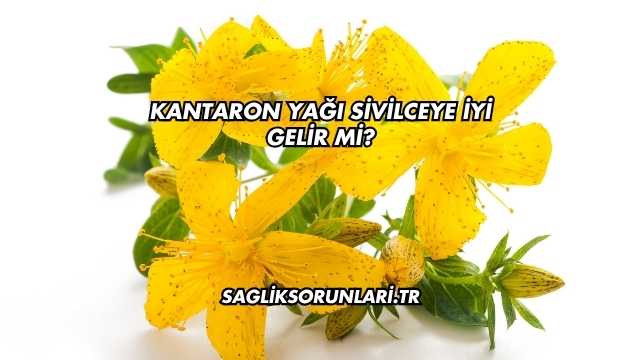 Kantaron Yağı Sivilceye İyi Gelir mi?