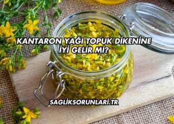 Kantaron Yağı Topuk Dikenine İyi Gelir mi?