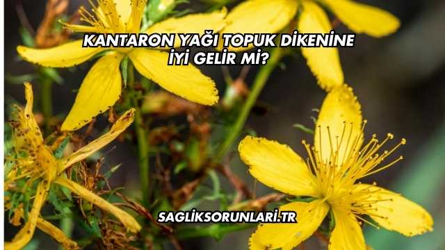 Kantaron Yağı Topuk Dikenine İyi Gelir mi?