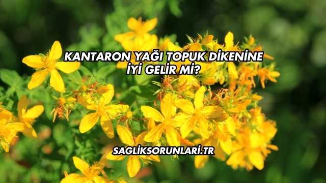 Kantaron Yağı Topuk Dikenine İyi Gelir mi?
