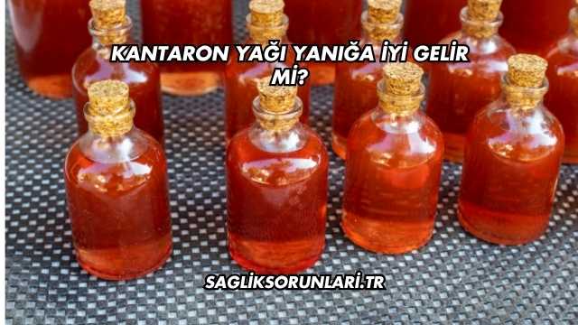 Kantaron Yağı Yanığa İyi Gelir mi?